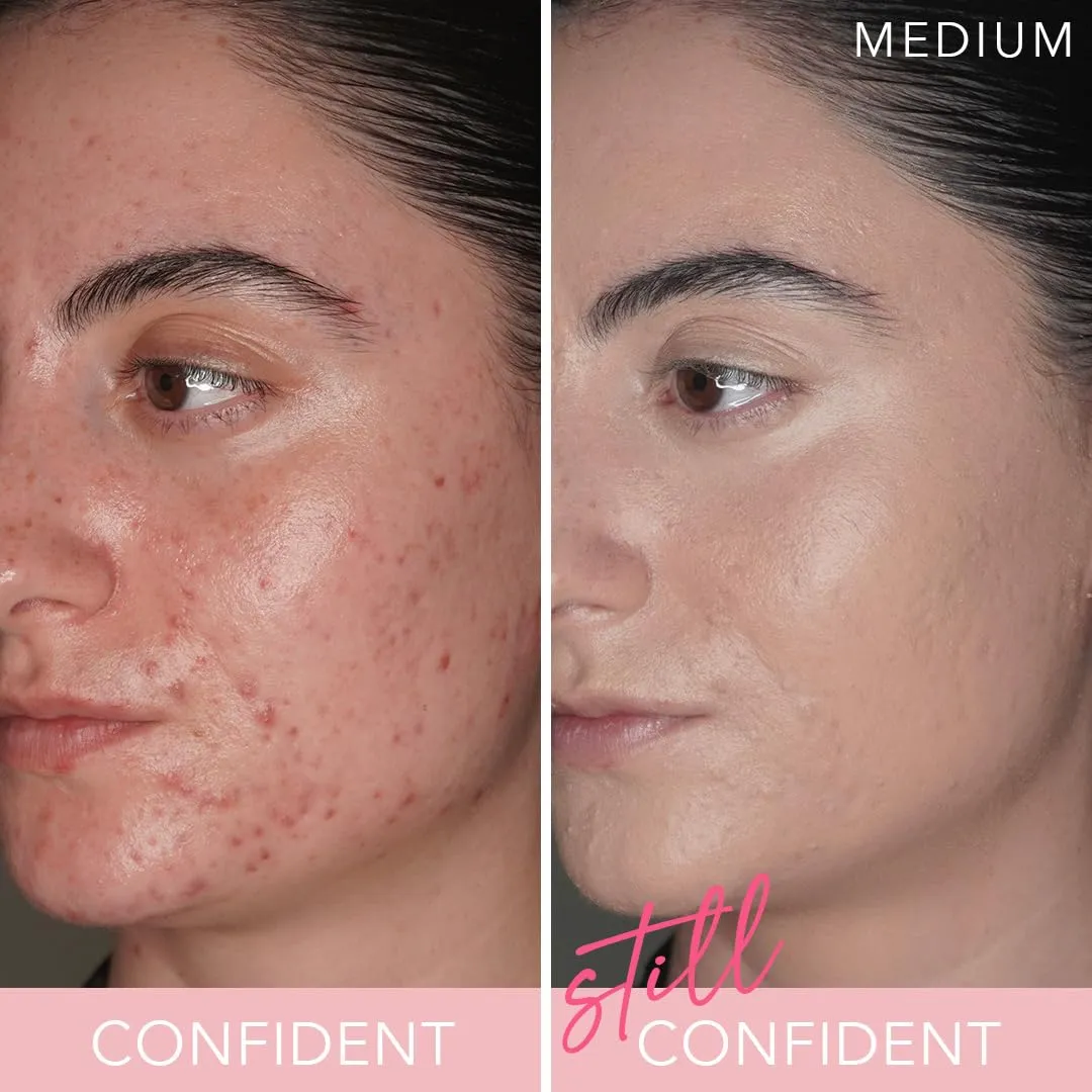 T.C.E This Covers Everything Super Coverage Serum Makeup with Peptides (Medium, One Size)
